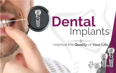 root canal treatment price gurgaon